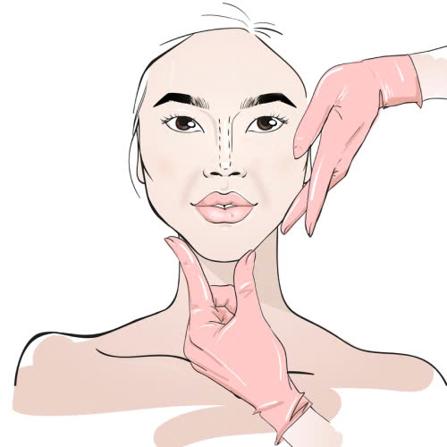 phau-thuat-nang-nen-canh-mui-khi-nao-nen-lam-va-ai-la-nguoi-phu-hop