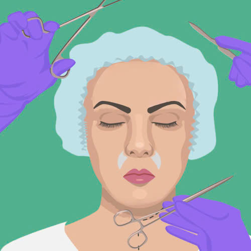 phau-thuat-nang-nen-canh-mui-khi-nao-nen-lam-va-ai-la-nguoi-phu-hop