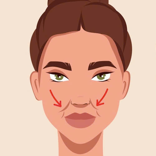 phau-thuat-nang-nen-canh-mui-khi-nao-nen-lam-va-ai-la-nguoi-phu-hop