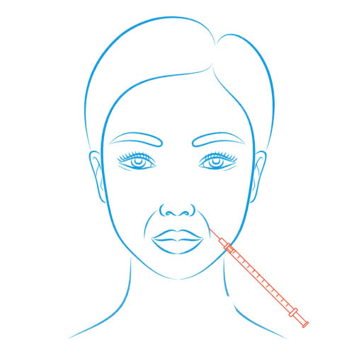 phuong-phap-nang-nen-canh-mui-moi-nhat-la-gi-giai-phap-nao-dang-duoc-nhieu-khach-hang-lua-chon