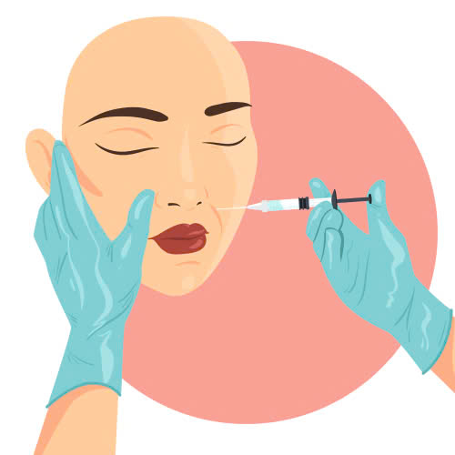 sua-nen-canh-mui-bi-lech-nguyen-nhan-giai-phap-va-nhung-dieu-can-biet-truoc-khi-thuc-hien