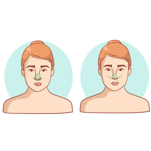 top-4-cach-lam-canh-mui-can-doi-giup-guong-mat-hai-hoa-ua-nhin-hon