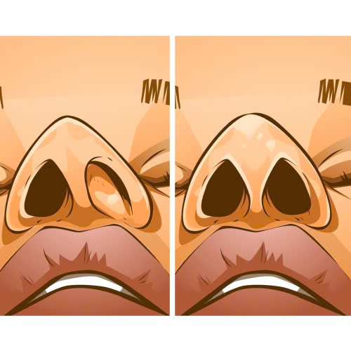 can-chinh-canh-mui-bi-veo-bi-quyet-lay-lai-dang-mui-can-doi-khong-can-chinh-sua-nhieu