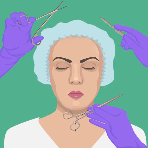 can-chinh-canh-mui-co-dau-khong-su-that-ban-nen-biet-truoc-khi-thuc-hien