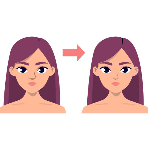 toan-bo-quy-trinh-chinh-hinh-canh-mui-sau-nang-tu-a-z-nhung-dieu-ban-can-biet