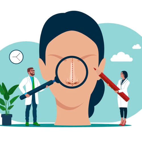 toan-bo-quy-trinh-chinh-hinh-canh-mui-sau-nang-tu-a-z-nhung-dieu-ban-can-biet