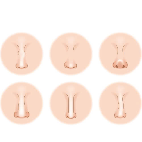 co-nen-can-chinh-canh-mui-khong-bat-mi-cac-phuong-phap-khong-phau-thuat-an-toan-tai-nha