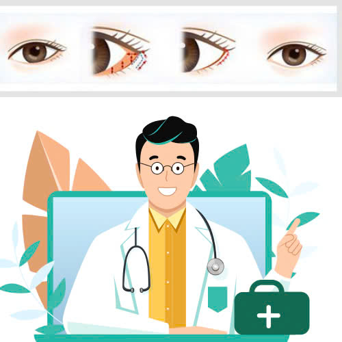 co-nen-mo-goc-mat-ngoai-khong-nhung-ai-nen-va-khong-nen-thuc-hien-phuong-phap-nay