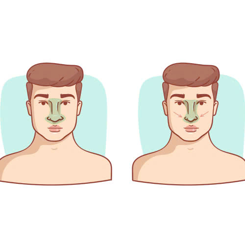 lam-sao-de-chon-duoc-dia-chi-can-chinh-canh-mui-uy-tin-va-an-toan-hien-nay