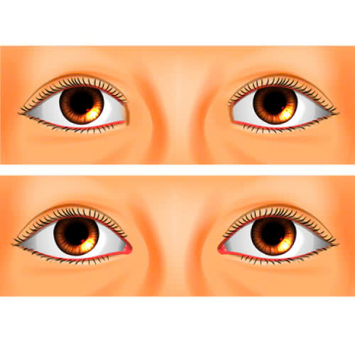 dia-chi-mo-goc-mat-trong-dep-tieu-chi-lua-chon-va-nhung-luu-y-khong-the-thieu