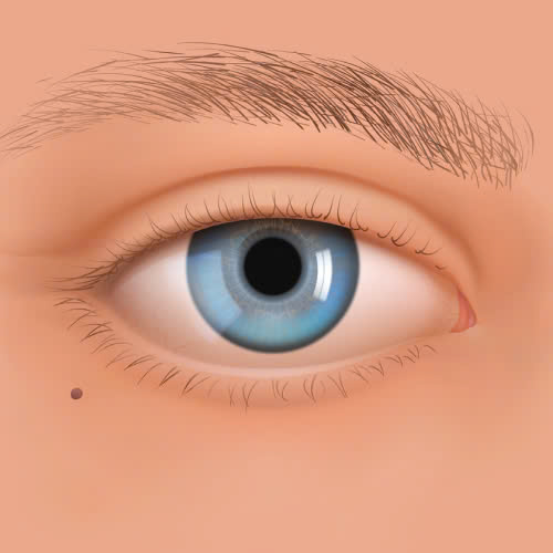 dia-chi-mo-goc-mat-trong-dep-tieu-chi-lua-chon-va-nhung-luu-y-khong-the-thieu