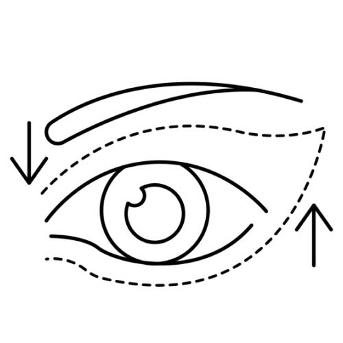 co-nen-ket-hop-mo-goc-mat-ngoai-va-trong-khong