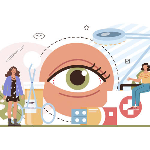 co-nen-ket-hop-mo-goc-mat-ngoai-va-trong-khong