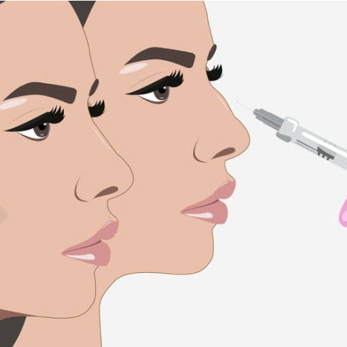 phuong-phap-khac-phuc-mui-go-ma-khong-can-phau-thuat-phu-hop-voi-nhung-ai