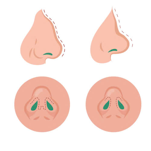 mai-go-mui-co-de-lai-seo-khong-nhung-dieu-ban-nhat-dinh-phai-biet-truoc-khi-lam