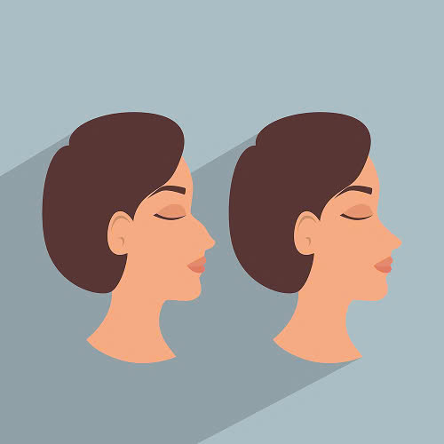 mai-go-mui-gia-bao-nhieu-giai-dap-chi-tiet-cho-cho-nguoi-co-y-dinh-tham-my