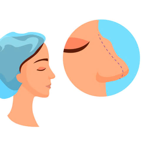 mai-go-mui-giu-duoc-bao-lau-giai-dap-chi-tiet-cho-nguoi-dang-muon-cai-thien-dang-mui-go