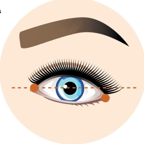 mo-goc-mat-ngoai-bi-bien-chung-nguyen-nhan-dau-hieu-va-cach-phong-tranh