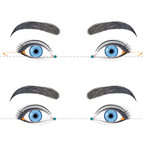 mo-goc-mat-ngoai-chinh-mat-xech-ai-se-la-nguoi-phu-hop-voi-phuong-phap-nay