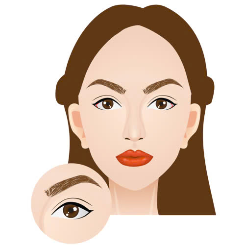 mo-goc-mat-ngoai-cho-mat-mi-lot-giai-phap-cai-thien-doi-mat-nho-thieu-cuon-hut