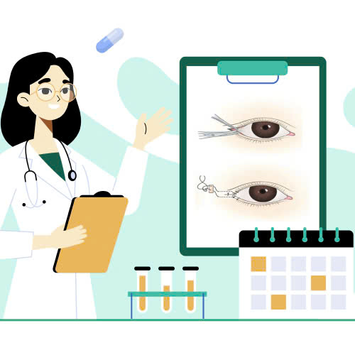 mo-goc-mat-ngoai-la-gi-tat-ca-thong-tin-ban-can-biet-truoc-khi-thuc-hien