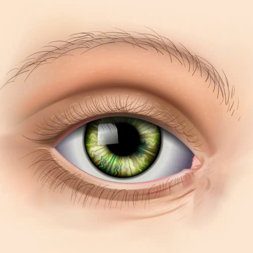 mo-goc-mat-trong-bi-bien-chung-nguyen-nhan-dau-hieu-va-cach-khac-phuc-an-toan