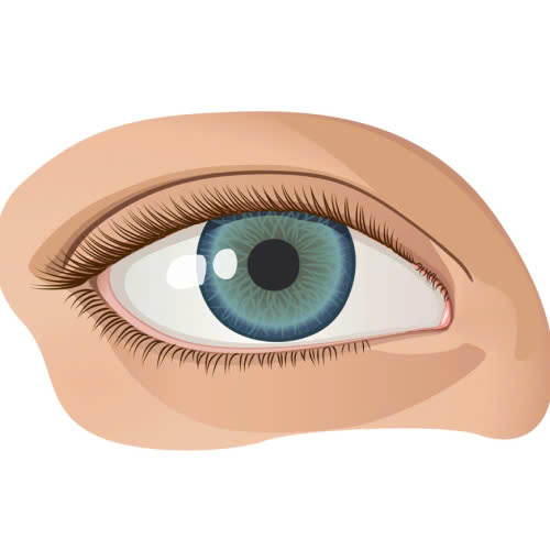 giai-dap-noi-lo-mo-goc-mat-trong-co-bi-rut-lai-khong-nguyen-nhan-cach-phong-tranh