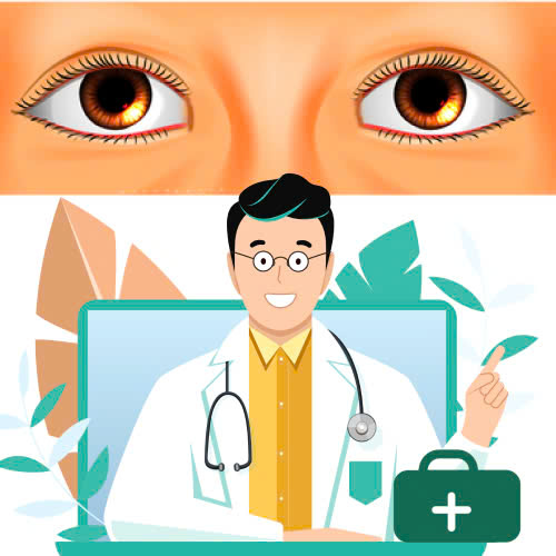 mo-goc-mat-trong-co-dau-khong-nhung-dieu-ban-can-biet-truoc-khi-thuc-hien