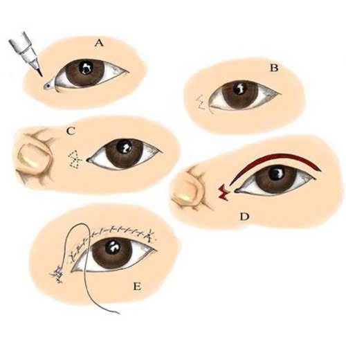 mo-goc-mat-trong-co-lam-thay-doi-tuong-so-khong-goc-nhin-tu-tham-my-va-nhan-tuong-hoc