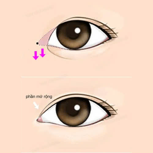 mo-goc-mat-trong-co-lam-thay-doi-tuong-so-khong-goc-nhin-tu-tham-my-va-nhan-tuong-hoc