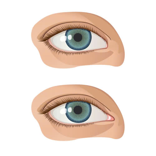 mo-goc-mat-trong-giup-mat-to-hon-khong-su-that-ban-can-biet-truoc-khi-tham-my