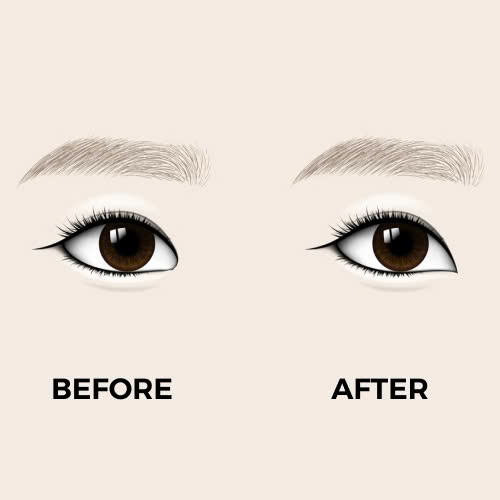 mo-goc-mat-trong-o-dau-uy-tin-5-tieu-chi-vang-giup-ban-chon-dung-noi-lam-dep-an-toan