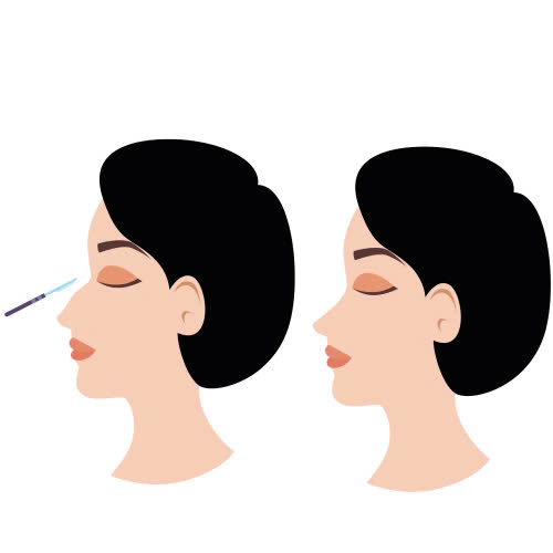 mui-bi-go-phai-lam-sao-3-cach-khac-phuc-hieu-qua-giup-ban-tu-tin-hon-moi-ngay