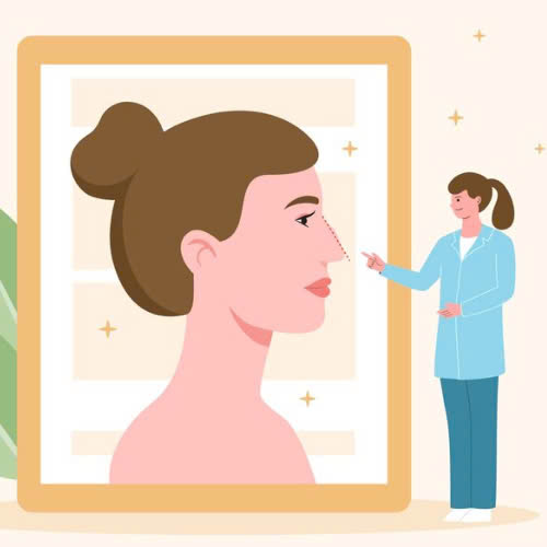 mui-go-nhe-co-can-mai-khong-nhung-dieu-ban-can-biet-truoc-khi-quyet-dinh