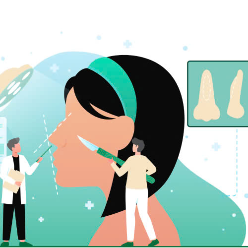 review-mai-go-mui-co-nen-lam-khong-kinh-nghiem-thuc-te-tu-nguoi-da-trai-nghiem