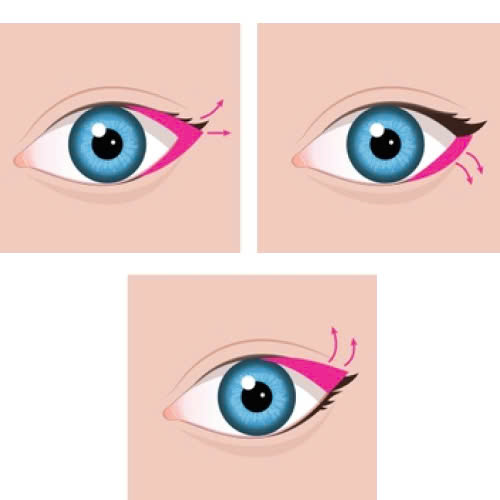 review-mo-goc-mat-ngoai-kinh-nghiem-thuc-te-loi-khuyen-danh-cho-ban