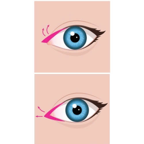 review-mo-goc-mat-trong-co-nen-thuc-hien-hieu-qua-ra-sao