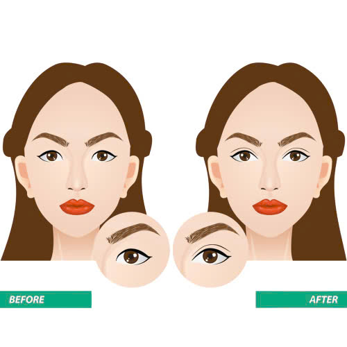 review-mo-goc-mat-trong-co-nen-thuc-hien-hieu-qua-ra-sao