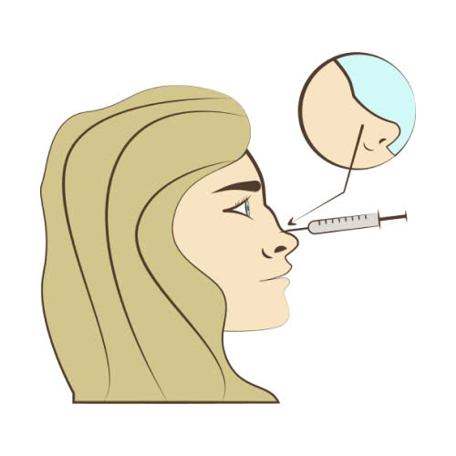 tiem-filler-mui-bao-lau-thi-dep-giai-dap-tu-a-z-cho-nguoi-moi