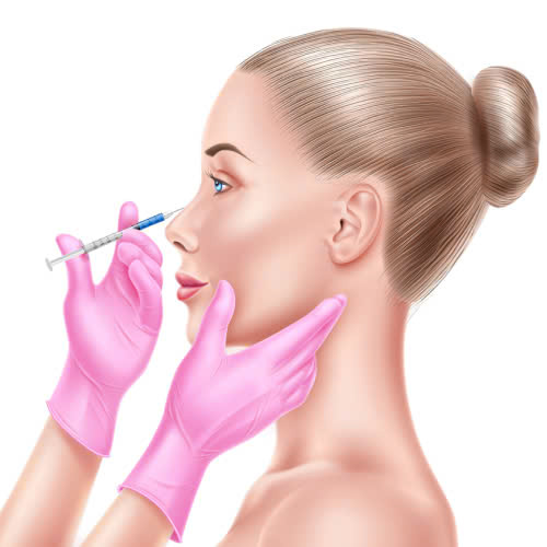 tiem-filler-mui-bi-bien-chung-nguyen-nhan-dau-hieu-va-cach-xu-ly-an-toan