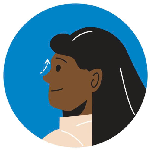 tiem-filler-mui-bi-lech-nguyen-nhan-dau-hieu-va-cach-xu-ly-an-toan