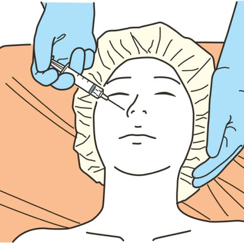 tiem-filler-mui-co-nguy-hiem-khong-su-that-ai-cung-nen-biet-truoc-khi-lam-dep