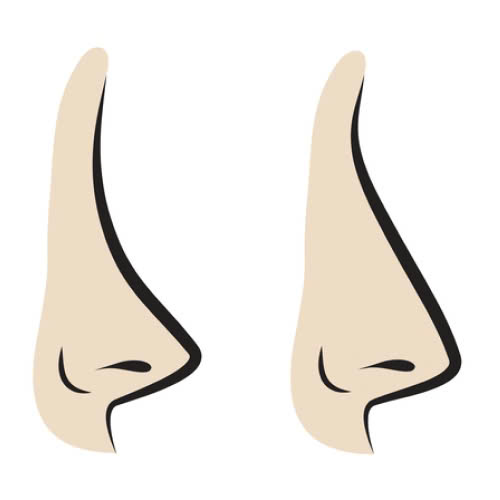 tiem-filler-mui-khac-phuc-mui-tet-giai-phap-lam-dep-khong-dao-keo