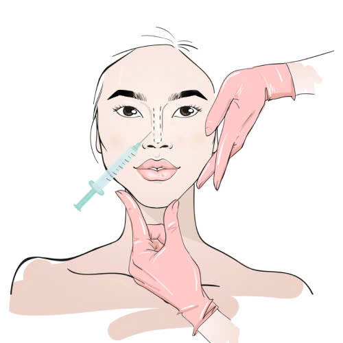 tiem-filler-mui-o-dau-dep-bi-quyet-chon-dung-dia-chi-cho-dang-mui-thanh-tu-tu-nhien-va-an-toan