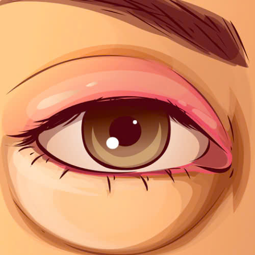 bien-chung-sau-cat-mat-2-mi-full-nguyen-nhan-cach-phong-ngua-va-khac-phuc