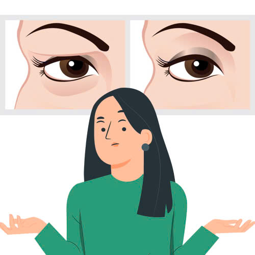 cat-mat-2-mi-full-bi-sung-bao-lau-va-cach-giam-sung-hieu-qua