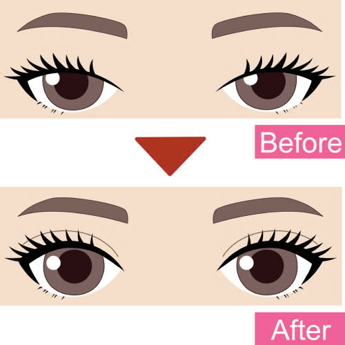 cat-mat-2-mi-full-la-gi-thong-tin-ban-can-biet-truoc-khi-lam-dep