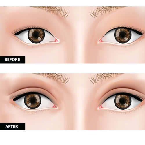 cat-mat-2-mi-full-la-gi-thong-tin-ban-can-biet-truoc-khi-lam-dep