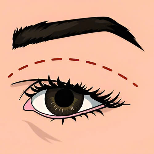 cat-mi-full-bo-da-du-co-dau-khong-bi-quyet-giup-ban-hoi-phuc-nhanh-it-sung