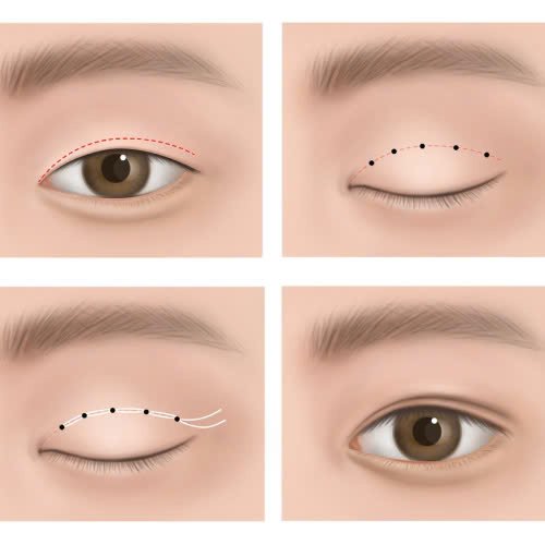 cat-mi-full-bo-da-du-co-dau-khong-bi-quyet-giup-ban-hoi-phuc-nhanh-it-sung